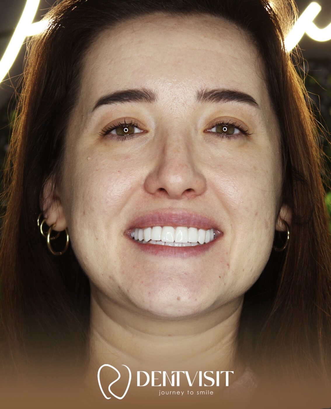 DentVisit — Gülüş Dönüşümü