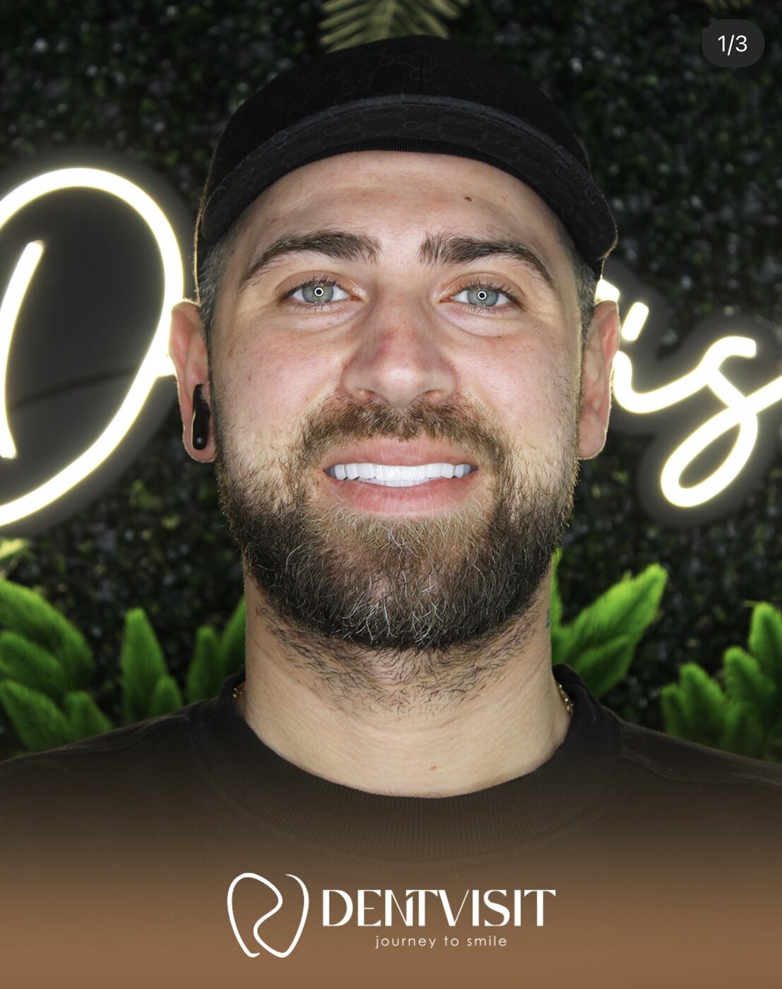 DentVisit — Hollywood Gülüşü
